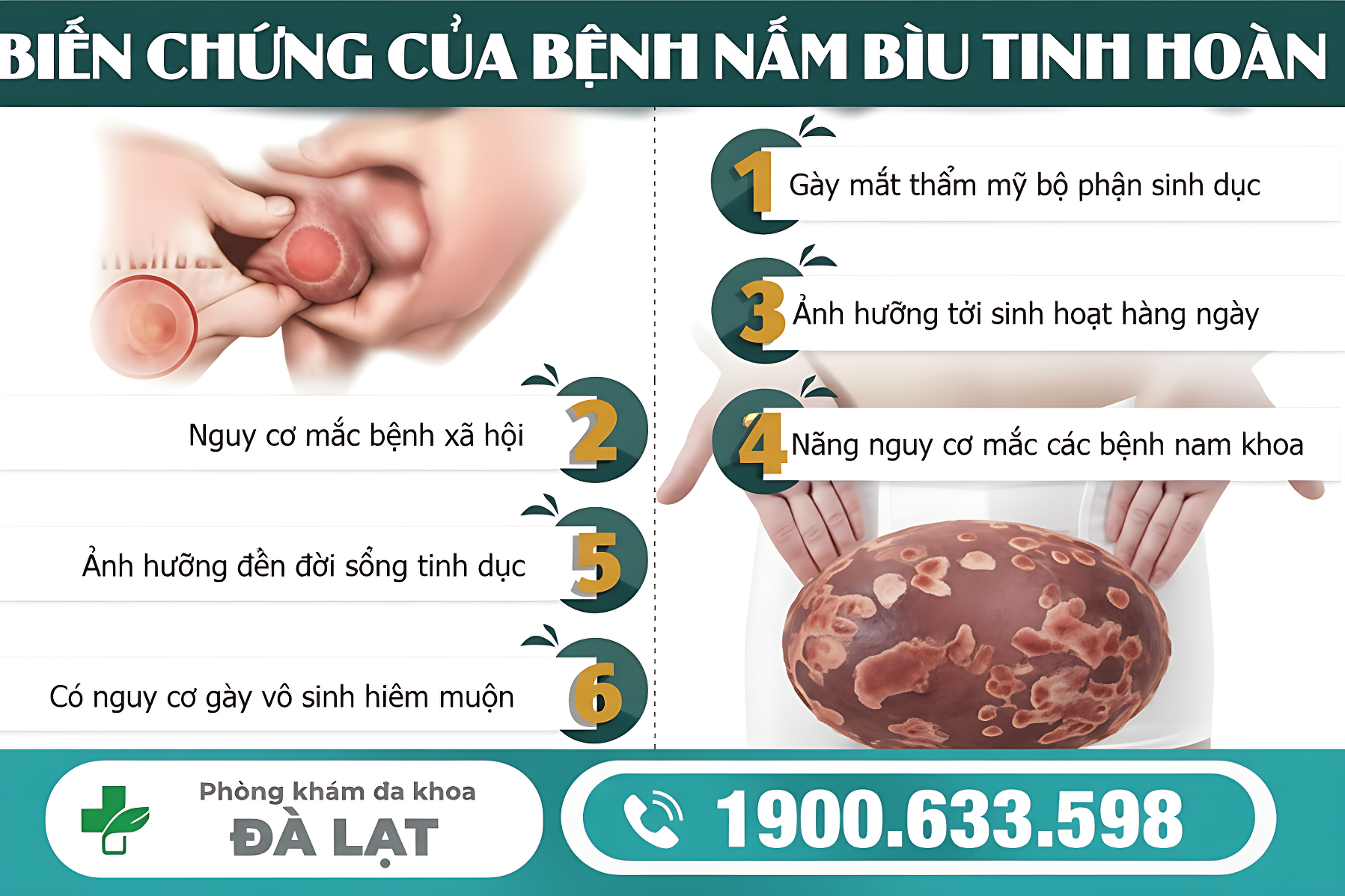 Hình ảnh minh họa